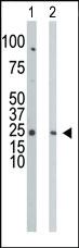 Anti-UCK1 Rabbit Polyclonal Antibody