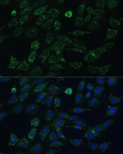 Immunofluorescence analysis of C6 cells using Anti-GK2 Antibody (A306809) at a dilution of 1:100. DAPI was used to stain the cell nuclei (blue).