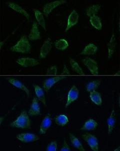 Immunofluorescence analysis of L929 cells using Anti-GK2 Antibody (A306809) at a dilution of 1:100. DAPI was used to stain the cell nuclei (blue).