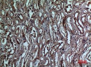 Anti-BNIP3 Rabbit Polyclonal Antibody