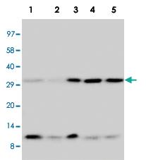 Anti-Ubiquitin Rabbit Polyclonal Antibody