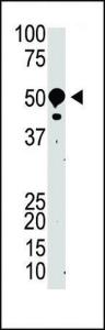 Anti-SUV39H2 Rabbit Polyclonal Antibody (Biotin)