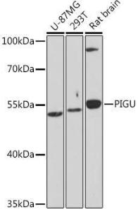 Western blot analysis of extracts of various cell lines, using Anti-Pigu Antibody (A306810) at 1:1,000 dilution. The secondary antibody was Goat Anti-Rabbit IgG H&L Antibody (HRP) at 1:10,000 dilution.