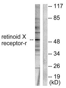 Western blot analysis of lysates from HepG2 cells using Anti-Retinoid X Receptor gamma Antibody. The right hand lane represents a negative control, where the Antibody is blocked by the immunising peptide