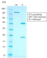 SDS-PAGE analysis of Anti-Cytokeratin 7 Antibody [rOV-TL12/30] under non-reduced and reduced conditions; showing intact IgG and intact heavy and light chains, respectively SDS-PAGE analysis confirms the integrity and purity of the antibody