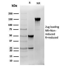 SDS-PAGE analysis of Anti-S100 beta Antibody [S100B/4141] under non-reduced and reduced conditions; showing intact IgG and intact heavy and light chains, respectively. SDS-PAGE analysis confirms the integrity and purity of the antibody.