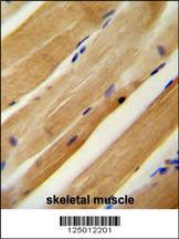 Anti-MLXIP Rabbit Polyclonal Antibody (AP (Alkaline Phosphatase))