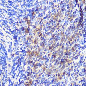 Anti-ATG10 antibody