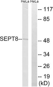 Western blot analysis of lysates from HeLa cells using Anti-SEPT8 Antibody. The right hand lane represents a negative control, where the antibody is blocked by the immunising peptide