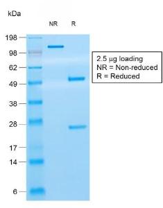 SDS-PAGE analysis of Anti-CD8A Antibody [rC8/468] under non-reduced and reduced conditions; showing intact IgG and intact heavy and light chains, respectively. SDS-PAGE analysis confirms the integrity and purity of the Antibody