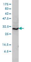 Anti-STX6 Mouse Monoclonal Antibody [clone: 1G2]