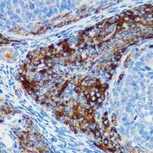 Immunohistochemistry analysis of paraffin-embedded rat ovary using Anti-Pigu Antibody (A306810) at a dilution of 1:100 (40x lens). Perform microwave antigen retrieval with 10 mM PBS buffer pH 7.2 before commencing with IHC staining protocol.