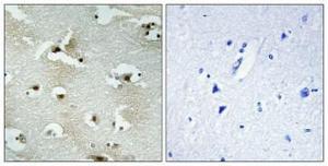 Immunohistochemical analysis of paraffin-embedded human brain using Anti-UTP14A Antibody 1:100 (4°C overnight). The right hand panel represents a negative control, where the antibody was pre-incubated with the immunising peptide