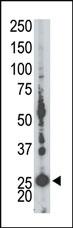 Anti-AK5 Rabbit Polyclonal Antibody