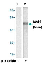 Anti-MAPT Rabbit Polyclonal Antibody