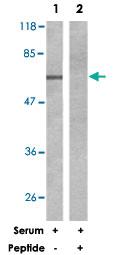 Anti-RPS6KB1 Rabbit Polyclonal Antibody