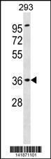 Anti-ATP6AP2 Rabbit Polyclonal Antibody (FITC (Fluorescein Isothiocyanate))