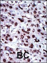 Anti-AK5 Rabbit Polyclonal Antibody