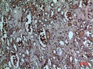 Anti-BNIP3 Rabbit Polyclonal Antibody