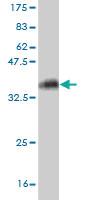 Anti-KCNMB3 Mouse Monoclonal Antibody [clone: 5H1]