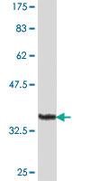 Anti-PIP5K1A Mouse Polyclonal Antibody