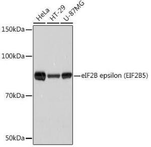 Western blot analysis of extracts of various cell lines, using Anti-EIF2B5 Antibody [ARC1774] (A306812) at 1:1,000 dilution