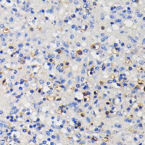 Immunohistochemistry analysis of paraffin-embedded human spleen using Anti-CD11a Antibody [ARC0344] (A308023) at a dilution of 1:100 (40X lens). Perform microwave antigen retrieval with 10 mM PBS buffer pH 7.2 before commencing with IHC staining protocol