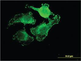 Anti-UNC5CL Mouse Monoclonal Antibody [clone: 3G7]