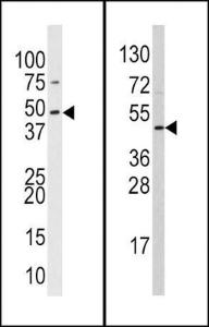 Anti-SUV39H2 Rabbit Polyclonal Antibody (APC (Allophycocyanin))