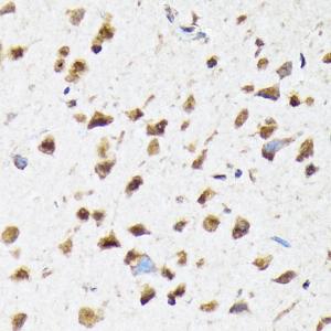 Immunohistochemistry analysis of paraffin-embedded rat brain using Anti-EIF2B5 Antibody [ARC1774] (A306812) at a dilution of 1:100 (40X lens). Perform microwave antigen retrieval with 10 mM Tris/EDTA buffer pH 9.0 before commencing with IHC staining protocol