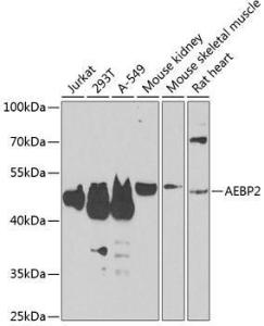 Western blot analysis of extracts of various cell lines, using Anti-AEBP2 Antibody (A12114) at 1:1,000 dilution