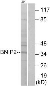 Western blot analysis of lysates from Jurkat cells using Anti-BNIP2 Antibody. The right hand lane represents a negative control, where the antibody is blocked by the immunising peptide.