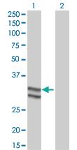 Anti-SERPINC1 Mouse Monoclonal Antibody [clone: 2B12]