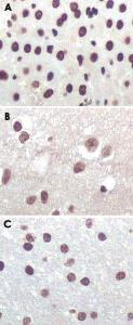 Anti-CDKN2A Mouse Monoclonal Antibody [clone: 2D9A12]