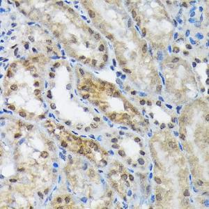 Immunohistochemistry analysis of paraffin-embedded mouse kidney using Anti-EIF2B5 Antibody [ARC1774] (A306812) at a dilution of 1:100 (40X lens). Perform microwave antigen retrieval with 10 mM Tris/EDTA buffer pH 9.0 before commencing with IHC staining protocol