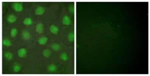 Immunofluorescence analysis of HUVEC cells using Anti-Retinoid X Receptor gamma Antibody. The right hand panel represents a negative control, where the Antibody was pre-incubated with the immunising peptide