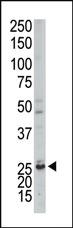 Anti-AK3 Rabbit Polyclonal Antibody