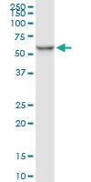 Anti-SERPINC1 Mouse Monoclonal Antibody [clone: 2B12]