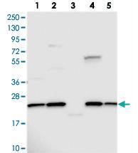 Anti-NPVF Rabbit Polyclonal Antibody