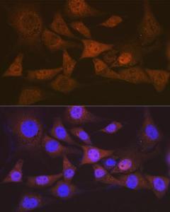 Immunofluorescence analysis of NIH-3T3 cells using Anti-EIF2B5 Antibody [ARC1774] (A306812) at a dilution of 1:100 (40X lens). DAPI was used to stain the cell nuclei (blue)