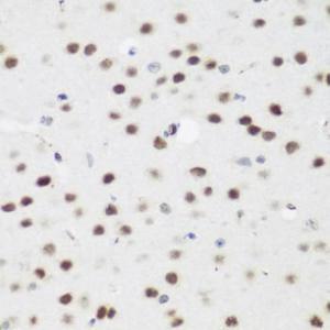 Immunohistochemistry analysis of paraffin-embedded mouse brain using Anti-AEBP2 Antibody (A12114) at a dilution of 1:200 (40X lens). Perform microwave antigen retrieval with 10 mM PBS buffer pH 7.2 before commencing with IHC staining protocol