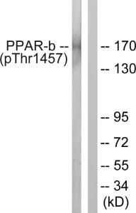 Anti-PPAR-BP