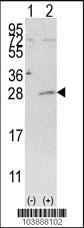 Anti-AK3 Rabbit Polyclonal Antibody