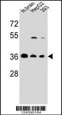 Anti-FBXO2 Rabbit Polyclonal Antibody (FITC (Fluorescein Isothiocyanate))