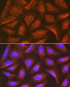 Immunofluorescence analysis of U-2 OS cells using Anti-EIF2B5 Antibody [ARC1774] (A306812) at a dilution of 1:100 (40X lens). DAPI was used to stain the cell nuclei (blue)