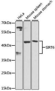 Western blot analysis of extracts of various cell lines, using Anti-SIRT6 Antibody (A12116) at 1:1,000 dilution