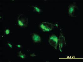 Anti-STX6 Mouse Monoclonal Antibody [clone: 1G2]