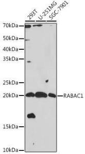 Western blot analysis of extracts of various cell lines, using Anti-PRA1 Antibody (A306813) at 1:1000 dilution. The secondary Antibody was Goat Anti-Rabbit IgG H&L Antibody (HRP) at 1:10000 dilution. Lysates/proteins were present at 25 µg per lane