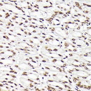 Immunohistochemistry analysis of paraffin-embedded mouse stomach using Anti-Rad21 Antibody (A305614) at a dilution of 1:200 (40x lens). Perform high pressure antigen retrieval with 10 mM citrate buffer pH 6.0 before commencing with IHC staining protocol