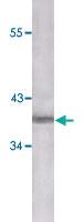 Anti-CDKN2A Mouse Monoclonal Antibody [clone: 2D9A12]